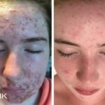 318dmkskin_skincat_active1537434303